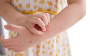 Managing Seasonal Allergies in Children