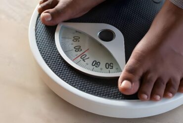 Hormonal imbalance and weight gain