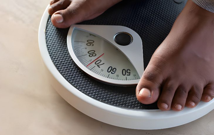 Hormonal imbalance and weight gain