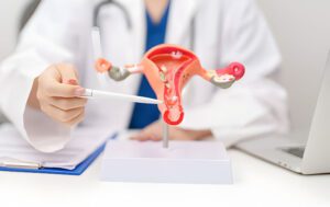 What Is PCOS? Causes, Symptoms and Treatment Options